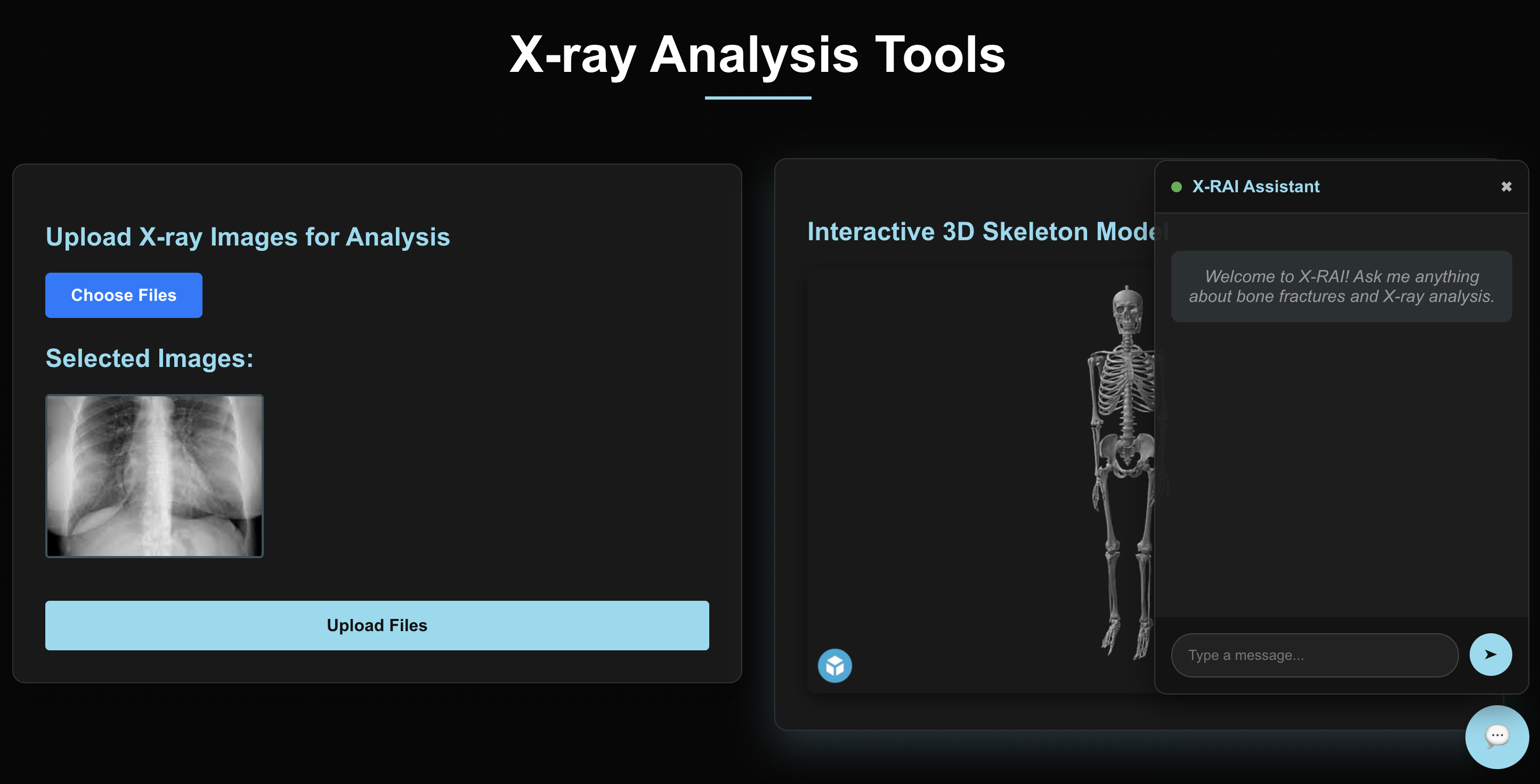 X-rAI: Computer Vision Fracture Platform